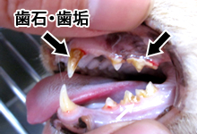 歯石歯垢