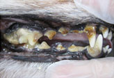 歯についた歯石